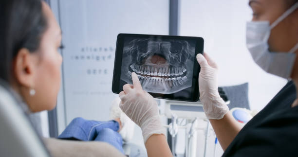 Licensed Tooth Extraction service in Newcastle, WA - Smile Center Dentistry